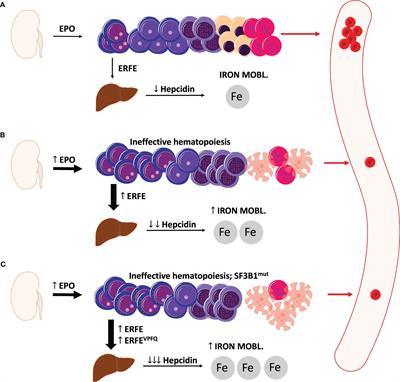 Understanding iron homeostasis in MDS: the role of erythroferrone